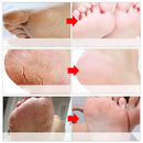 Exfoliating Foot Mask Spa Pedicure Socks Remove Dead Skin Whitening Feet Peeling Anti-Cracked Foot Skin Care - Tartaruga Shop