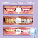 Pasta Clareadora Dental Para Uso Profissional - Tartaruga Shop